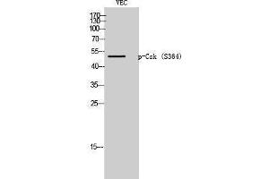 Western Blotting (WB) image for anti-C-Src tyrosine Kinase (CSK) (pSer364) antibody (ABIN3172998) (CSK antibody  (pSer364))