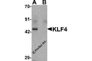 Western Blotting (WB) image for anti-Kruppel-Like Factor 4 (Gut) (KLF4) antibody (ABIN1031710) (KLF4 antibody)