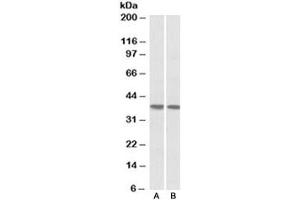 Western blot testing of human heart [A] and lung [B] lysates with KLF2 antibody at 1ug/ml. (KLF2 antibody)