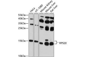 Western blot analysis of extracts of various cell lines, using RPS20 antibody (ABIN6129112, ABIN6147211, ABIN6147212 and ABIN6214592) at 1:1000 dilution. (RPS20 antibody  (AA 1-119))