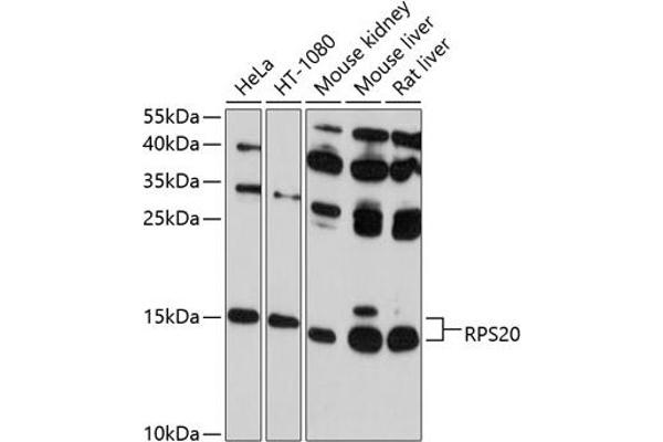 RPS20 Antikörper  (AA 1-119)