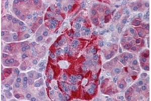 Human Pancreas: Formalin-Fixed, Paraffin-Embedded (FFPE) (EPHX4 antibody  (AA 71-120))