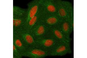 IF analysis of TOE1 using anti-TOE1 antibody (ABIN7601080) and anti-Tubulin Alpha antibody (ABIN7600339). (TOE1 antibody  (AA 28-501))