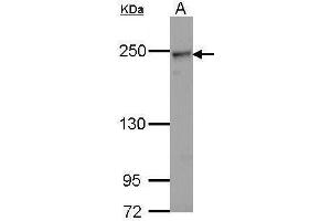 WB Image Sample (30 ug of whole cell lysate) A: Hela 5% SDS PAGE antibody diluted at 1:1000 (COL4a2 antibody)