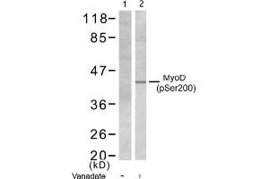 Image no. 1 for anti-Myogenic Differentiation 1 (MYOD1) (pSer200) antibody (ABIN196752) (MYOD1 antibody  (pSer200))