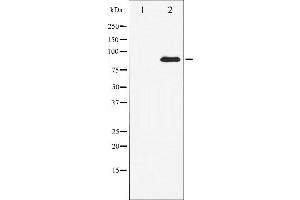 Western blot analysis of STAT3 expression in HeLa whole cell lysates,The lane on the left is treated with the antigen-specific peptide.