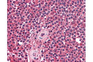 Anti-CXCR5 antibody IHC of human spleen. (CXCR5 antibody)