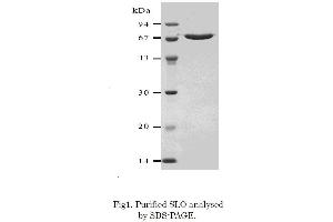 Western Blotting (WB) image for Streptolysin O (SLO) (Active) protein (ABIN2452205) (Streptolysin O Protein (SLO))