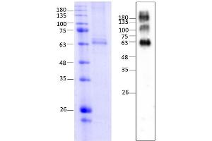 Mouse Melanocortin 4 Receptor (MC4R) (AA 1-332), Fraction 11-13 (MC4R Protein (AA 1-332) (Strep Tag))