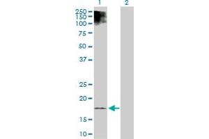 Western Blot analysis of ESM1 expression in transfected 293T cell line by ESM1 MaxPab polyclonal antibody. (ESM1 antibody  (AA 1-184))