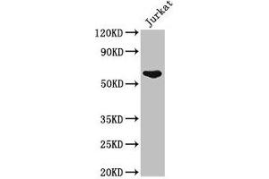 Western Blot Positive WB detected in: Jurkat whole cell lysate All lanes: UAP1 antibody at 2. (UAP1 antibody  (AA 1-522))