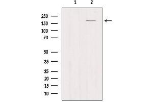 Western blot analysis of extracts from Myeloma cells, using MRC1 Antibody. (Macrophage Mannose Receptor 1 antibody  (Internal Region))