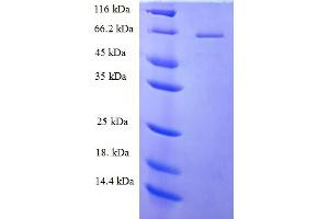 SDS-PAGE (SDS) image for Phospholipase C zeta 1 (PLCz1) (AA 1-415), (partial) protein (His-SUMO Tag) (ABIN4976378)
