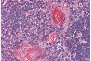 Human Thymus (formalin-fixed, paraffin-embedded) stained with SMC4 antibody ABIN290379 at 5 ug/ml followed by biotinylated goat anti-rabbit IgG secondary antibody ABIN481713, alkaline phosphatase-streptavidin and chromogen. (SMC4 antibody  (AA 281-297))