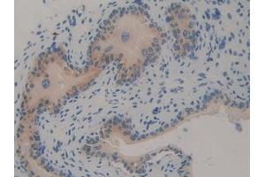 Detection of TRAF2 in Mouse Vas Deferens Tissue using Polyclonal Antibody to TNF Receptor Associated Factor 2 (TRAF2) (TRAF2 antibody  (AA 238-491))