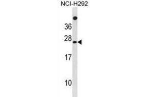 Western Blotting (WB) image for anti-Mannose-P-Dolichol Utilization Defect 1 (MPDU1) antibody (ABIN3001379)