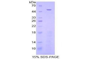 SDS-PAGE (SDS) image for Fibrinogen-Like 2 (FGL2) (AA 24-439) protein (His tag) (ABIN2124793)