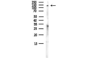 Western blot analysis of lysates from HepG2 cells(LPS,4h treatment), using MYBBP1A Antibody at 1/1000 dilution.