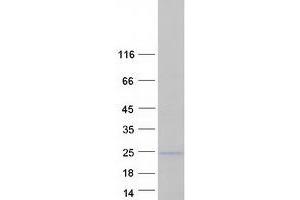 Western Blotting (WB) image for Sentan, Cilia Apical Structure Protein (Sntn) protein (Myc-DYKDDDDK Tag) (ABIN2731656)