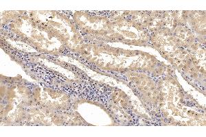 Detection of KPNa2 in Human Kidney Tissue using Monoclonal Antibody to Karyopherin Alpha 2 (KPNa2) (KPNA2 antibody  (AA 157-412))