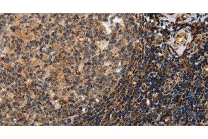 Immunohistochemistry of paraffin-embedded Human tonsil using PON1 Polyclonal Antibody at dilution of 1:40 (PON1 antibody)