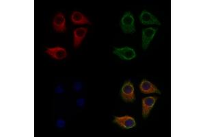 ABIN6263333 and ABIN6279546 staining Hela cells by IF/ICC.