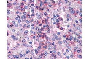SGK3 antibody was used for immunohistochemistry at a concentration of 4-8 ug/ml. (SGK3 antibody  (N-Term))