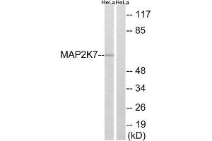 Western Blotting (WB) image for anti-Mitogen-Activated Protein Kinase Kinase 7 (MAP2K7) (Ser271) antibody (ABIN1848235) (MAP2K7 antibody  (Ser271))