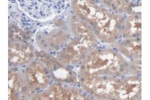 Detection of AST in Human Kidney Tissue using Polyclonal Antibody to Aspartate Aminotransferase (AST)