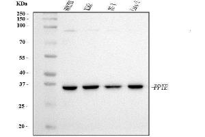 Western blot analysis of Cyclophilin E/PPIE using anti-Cyclophilin E/PPIE antibody (ABIN7599242). (PPIE antibody  (AA 1-301))