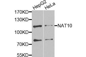 Western blot analysis of extracts of various cell lines, using NAT10 antibody. (NAT10 antibody)