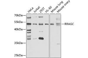 Western blot analysis of extracts of various cell lines, using RRAGC antibody (ABIN6132615, ABIN6147252, ABIN6147253 and ABIN6223371) at 1:1000 dilution. (GTR2 antibody  (AA 1-250))