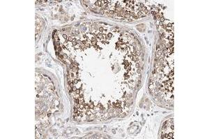 Immunohistochemical staining of human testis with C6orf118 polyclonal antibody  shows strong cytoplasmic positivity in subsets of seminiferus duct cells at 1:50-1:200 dilution. (C6ORF118 antibody)