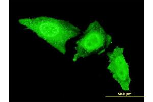 Immunofluorescence of monoclonal antibody to IRAK3 on HeLa cell.