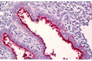 Anti-MUC16 / CA-125 antibody IHC staining of human uterus, endometrium.
