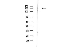 Western blot analysis of lysates from EC304 cells(heat-shock,45 min treatment), using Phospho-Flt3 / C (Tyr969) Antibody at 1/1000 dilution.