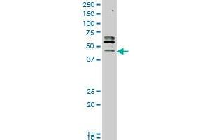 STK32C monoclonal antibody (M05), clone 3E8 Western Blot analysis of STK32C expression in MCF-7 . (STK32C antibody  (AA 1-369))