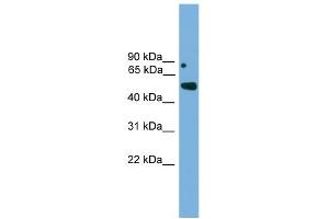 WB Suggested Anti-Irx5 Antibody Titration: 0. (IRX5 antibody  (Middle Region))
