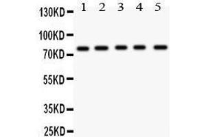 Anti- MCAK antibody, Western blotting All lanes: Anti MCAK  at 0. (KIF2C antibody  (AA 531-725))