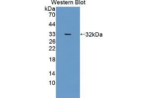 Figure. (Dickkopf-Like 1 (DKKL1) (AA 21-230) antibody)