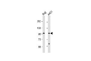 All lanes : Anti-NFKB1 Antibody  at 1:1000 dilution Lane 1: Raji whole cell lysate Lane 2: A431 whole cell lysate Lysates/proteins at 20 μg per lane. (NFKB1 antibody  (AA 911-939))