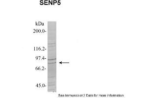 Sample Type: 1. (SENP5 antibody  (Middle Region))