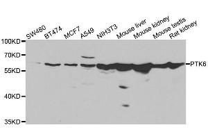 Western blot analysis of extracts of various cell lines, using PTK6 antibody. (PTK6 antibody  (AA 222-451))