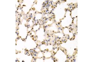 Immunohistochemistry of paraffin-embedded rat lung using SFN Antibody. (14-3-3 sigma/SFN antibody)