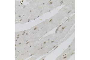 Immunohistochemistry of paraffin-embedded mouse heart using SRSF9 antibody (ABIN1877097) (40x lens).