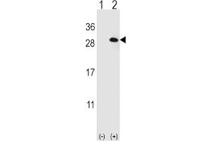 Western Blotting (WB) image for anti-Eukaryotic Translation Initiation Factor 4E Family Member 2 (EIF4E2) antibody (ABIN3001010)