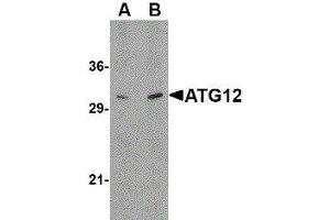 Western Blotting (WB) image for anti-Autophagy Related 12 (ATG12) (N-Term) antibody (ABIN2477525) (ATG12 antibody  (N-Term))