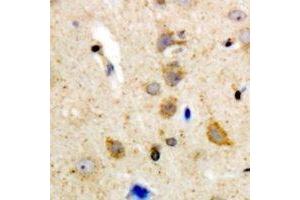 Immunohistochemical analysis of BLK staining in human brain formalin fixed paraffin embedded tissue section. (BLK antibody  (C-Term))