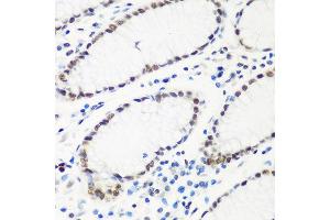 Immunohistochemistry of paraffin-embedded human stomach using HTATSF1 antibody at dilution of 1:100 (40x lens).