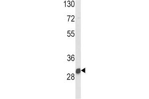 Western Blotting (WB) image for anti-N-Acetyltransferase 2 (Arylamine N-Acetyltransferase) (NAT2) antibody (ABIN3002917) (NAT2 antibody)